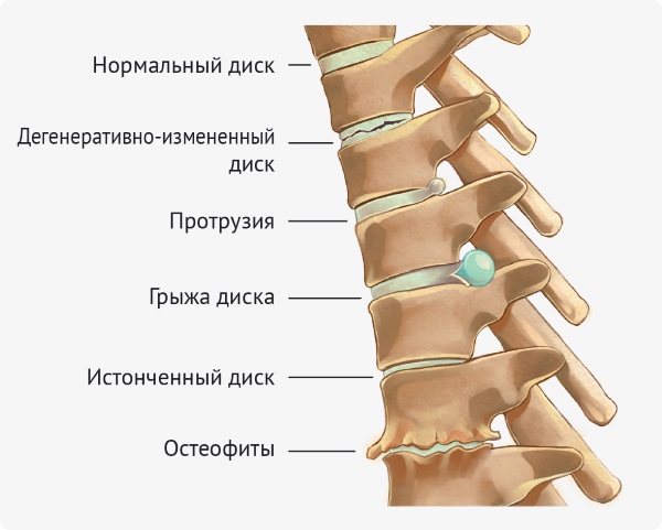 Ioga per a l’esquena i la columna vertebral: característiques, indicacions i contraindicacions, un conjunt d’exercicis senzills, les millors asanes. Vídeo per a principiants