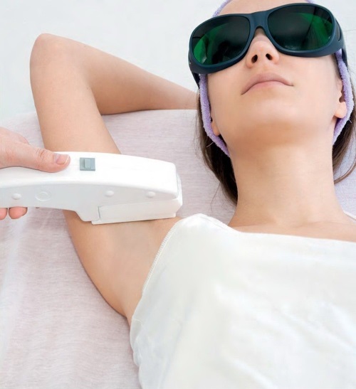 Épilation AFT - épilation au laser sur le visage et le corps, zone bikini au salon et à la maison. Appareils, avis et prix