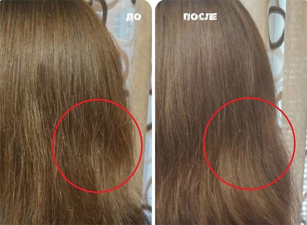 Huile d'amla pour les cheveux - avantages, recettes d'utilisation, qui convient, comment utiliser