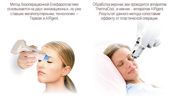Niet-chirurgische ooglidcorrectie van de boven- en onderoogleden: cirkelvormig, laser, hardware. Prijzen, revalidatie en mogelijke complicaties