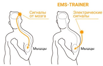 Formation EMS (EMS) - qu'est-ce que c'est, les avantages et les inconvénients, les résultats, les photos, les avis des médecins sur la myostimulation