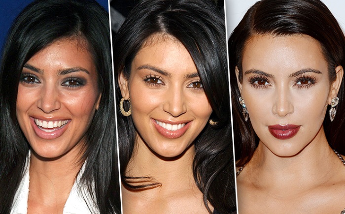 Kim Kardashian ภาพถ่ายศัลยกรรมพลาสติกชีวประวัติพารามิเตอร์รูปร่างส่วนสูงและน้ำหนัก รูปร่างหน้าตาของคุณเปลี่ยนไปอย่างไร?