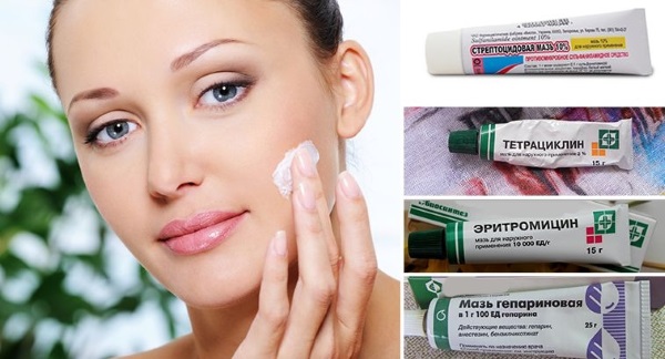De beste remedies voor acne in het gezicht. Voordelige crèmes, lotions, zalven in de apotheek