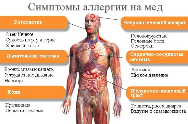 Medena masaža protiv celulita. Kako to učiniti ispravno za mršavljenje na trbuhu, leđima, nogama, stražnjici kod kuće. Video lekcije
