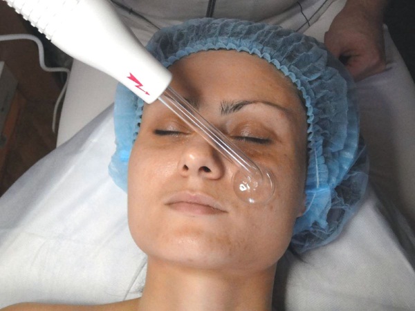 Akne na bradi kod žena na licu. Uzroci pojave nakon 30 godina, tijekom trudnoće. Koji je organ u kvaru, kućni lijekovi