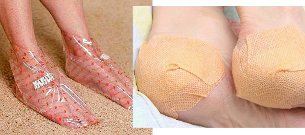 Nguyên nhân và cách điều trị nứt gót chân tại nhà. Chế phẩm, thuốc mỡ, hydrogen peroxide, aspirin, các biện pháp dân gian