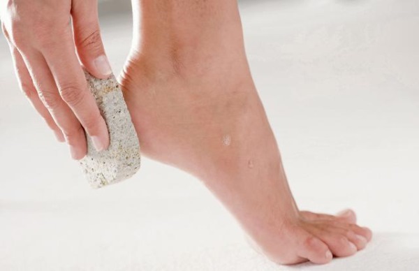 Nguyên nhân và cách điều trị nứt gót chân tại nhà.Chế phẩm, thuốc mỡ, hydrogen peroxide, aspirin, các biện pháp dân gian