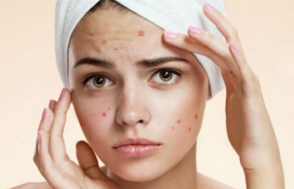 Cosmètics de farmàcia, classificació de popularitat: per a pells problemàtiques, per a acne, antienvelliment. Francès, rus, marques