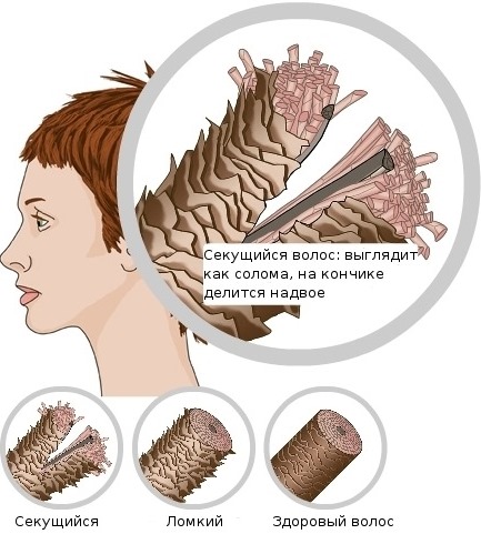Mummy untuk rambut. Sifat dan aplikasi dalam kosmetologi, bagaimana menambah syampu. Ulasan pakar trikologi dan ahli dermatologi