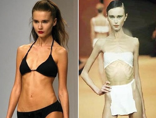 La pire personne au monde est une femme. Filles anorexiques, modèles, célébrités. Une photo