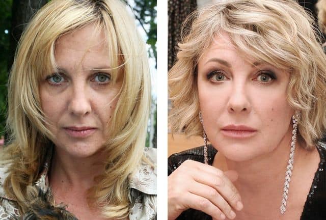 Bintang sebelum dan selepas pembedahan plastik. Foto Rusia, Hollywood, Korea, tidak berjaya, mangsa, Instagram, di rumah 2