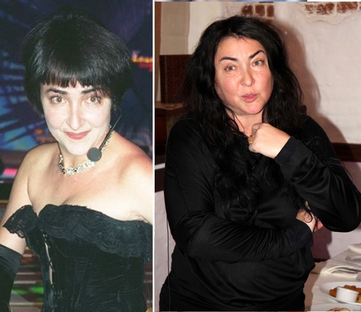 Bintang sebelum dan selepas pembedahan plastik.Foto Rusia, Hollywood, Korea, tidak berjaya, mangsa, Instagram, di rumah 2