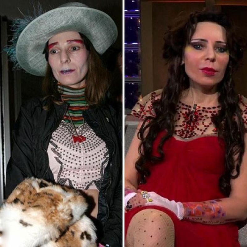 Bintang sebelum dan selepas pembedahan plastik. Foto Rusia, Hollywood, Korea, tidak berjaya, mangsa, Instagram, di rumah 2