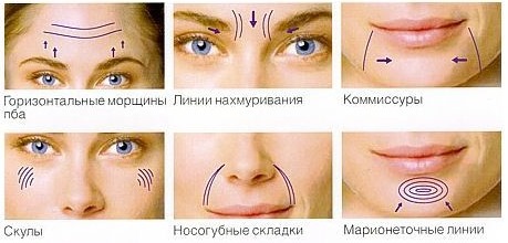 Lifting facial no quirúrgic amb Margarita Levchenko. Lliçons de formació en vídeo, els avantatges del mètode