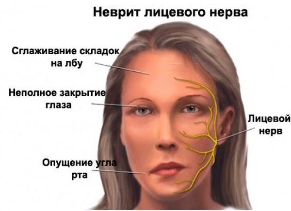 Non-surgical facelift with Margarita Levchenko. Training video lessons, the benefits of the method
