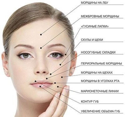 Hyaluronzuur in cosmetologie. Injecties, tabletten, gezichtscrèmes. Voordelen, voor en na foto's. Drug beoordelingen