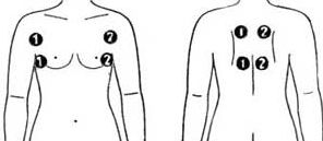Borstlift zonder implantaten. Procedures en methoden voor het elastisch maken van borsten in cosmetologie