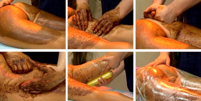 Celulite nas pernas e nádegas. Como se livrar das coxas, nádegas: massagem a vácuo com latas, envoltórios, produtos, massageadores, exercícios