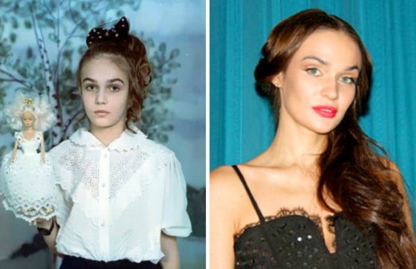 Alena Vodonaeva πριν και μετά τα πλαστικά. Φωτογραφία, παράμετροι σχήματος, ύψος, βάρος, χρώμα μαλλιών. Χειρουργική μείωση μύτης που έκανε στα δόντια
