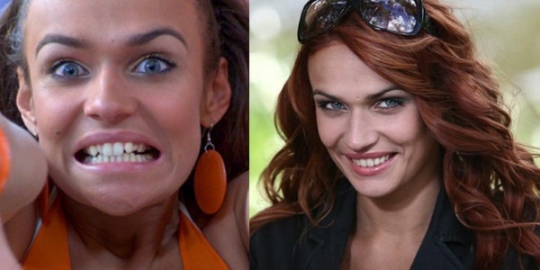 Alena Vodonaeva sebelum dan selepas plastik. Foto, parameter bentuk, tinggi, berat, warna rambut. Pembedahan pengurangan hidung yang dilakukan pada gigi