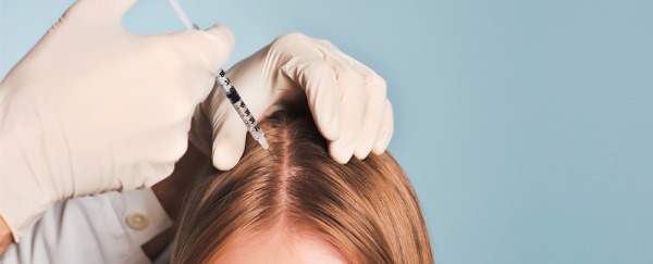 Mesoterapia del cuero cabelludo del cuero cabelludo. Qué es, efecto, precio. Como hacerlo en casa