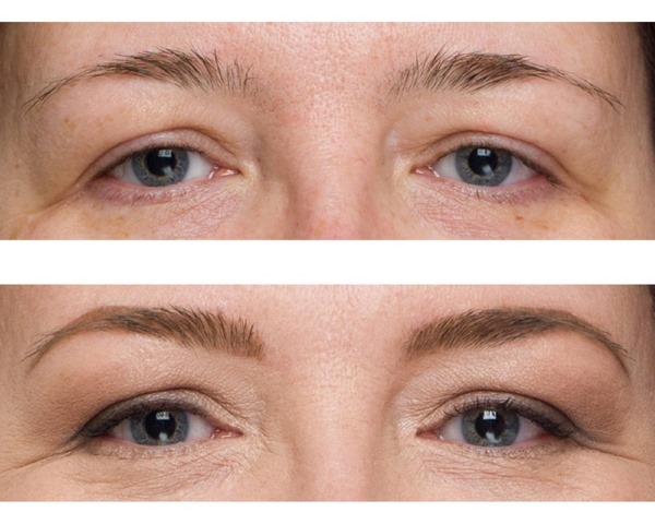 Ang Nicotinic acid para sa eyebrows at eyelashes sa ampoules. Application, kung paano gamitin, mga larawan, repasuhin