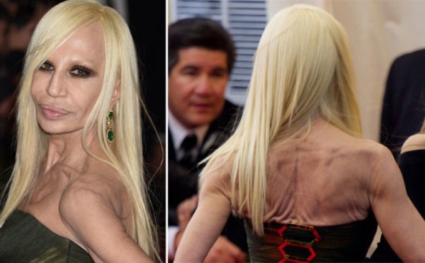 Donatella Versace voor en na plastische chirurgie. Foto, lengte, gewicht, biografie, leeftijd