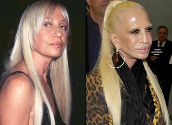 Donatella Versace voor en na plastische chirurgie. Foto, lengte, gewicht, biografie, leeftijd