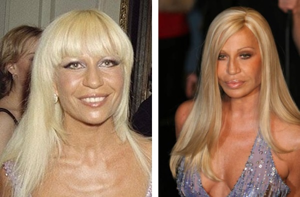Donatella Versace sebelum dan selepas pembedahan plastik. Foto, tinggi, berat badan, biografi, umur