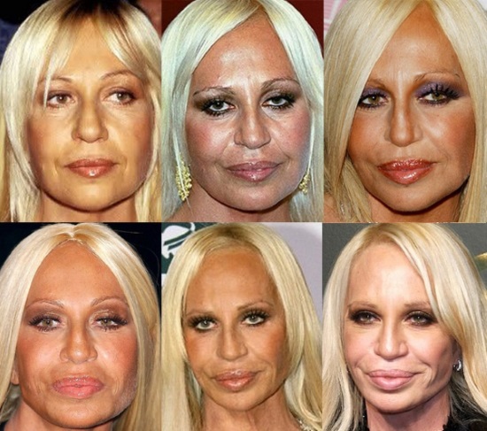 Donatella Versace abans i després de la cirurgia plàstica. Foto, alçada, pes, biografia, edat