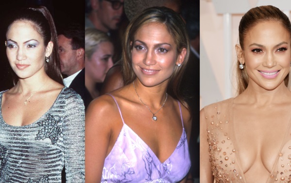 Jennifer Lopez. Foto dengan pakaian renang, gambarkan parameter sebelum dan selepas pembedahan plastik