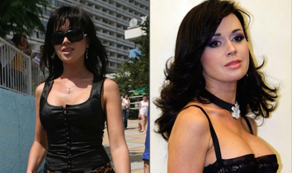 ممثلات روسيات ذوات صدر كبير قبل وبعد الجراحة التجميلية. صورة