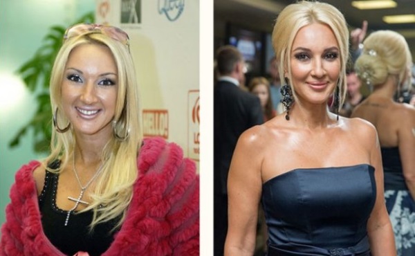 Actrices rusas de grandes pechos antes y después de la cirugía plástica. Una fotografía