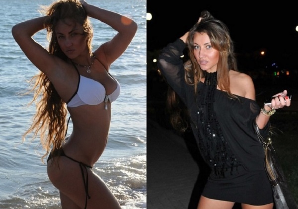 Victoria Bernikova sebelum dan selepas pembedahan plastik. Pilihan bentuk