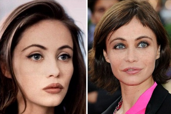 Oso Emmanuelle. Fotos antes y después de la cirugía plástica, como ha cambiado la actriz francesa