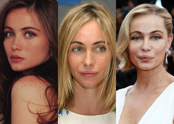 Emmanuelle Bear. Fotos antes e depois da cirurgia plástica, como a atriz francesa mudou