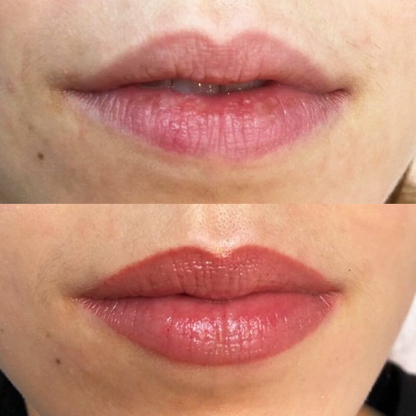 Rias bibir kekal dengan warna. Foto sebelum dan selepas prosedur, harga