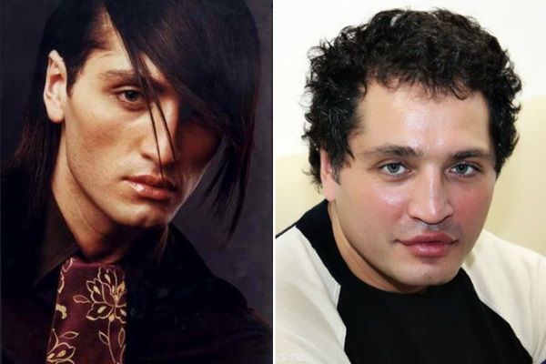 Rustam Solntsev abans i després de la cirurgia plàstica. Fotografia com es veu ara