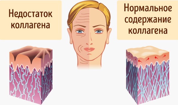 Injekcija konture lica. Što je. Fotografije prije i poslije, pripreme, cijena