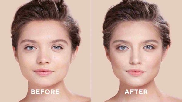 Como consertar o nariz de uma mulher com batatas. Rinoplastia, foto antes e depois da cirurgia, preço