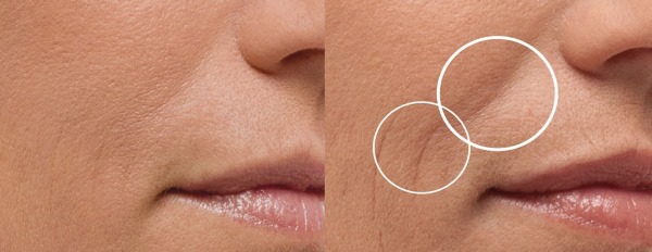 Masaż manualny całego ciała dla kobiet 40-50 lat przeciwzmarszczkowy twarzy. Rodzaje, instrukcje, zdjęcia, wyniki