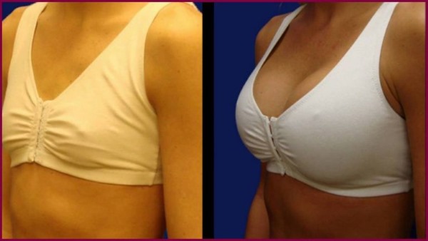 Opérations d'agrandissement du sein. Prix, photos avant et après, types, indications, résultats