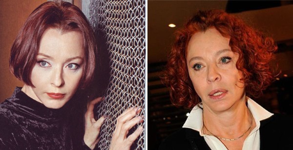Actrices rusas antes y después de la cirugía plástica facial. Una fotografía