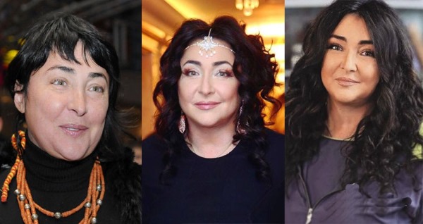 นักแสดงหญิงชาวรัสเซียก่อนและหลังการทำศัลยกรรมใบหน้า รูปภาพ