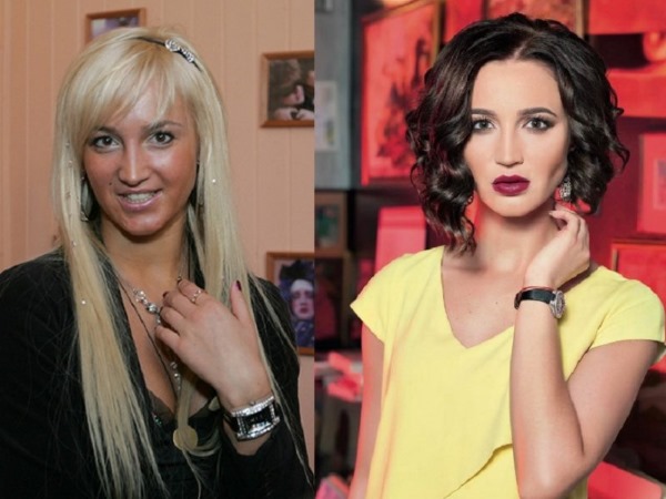 Руске глумице пре и после пластичне хирургије лица. Фото