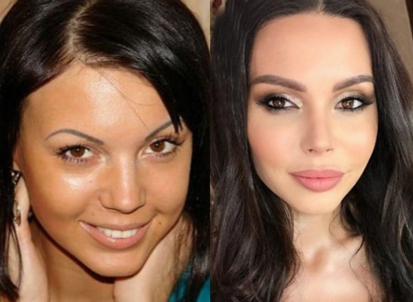 Pelakon Rusia sebelum dan selepas pembedahan plastik. Gambar