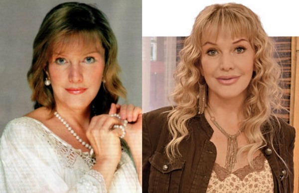 Pelakon Rusia sebelum dan selepas pembedahan plastik. Gambar
