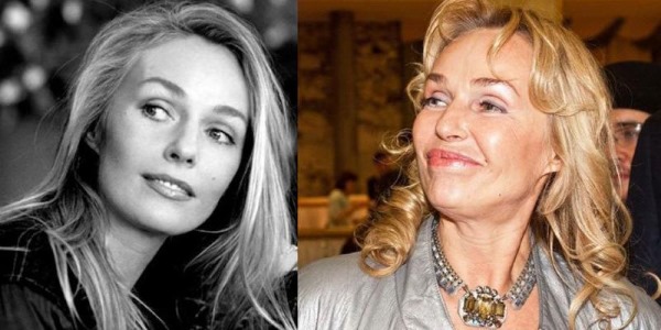 Nữ diễn viên Nga trước và sau khi phẫu thuật thẩm mỹ khuôn mặt. Một bức ảnh