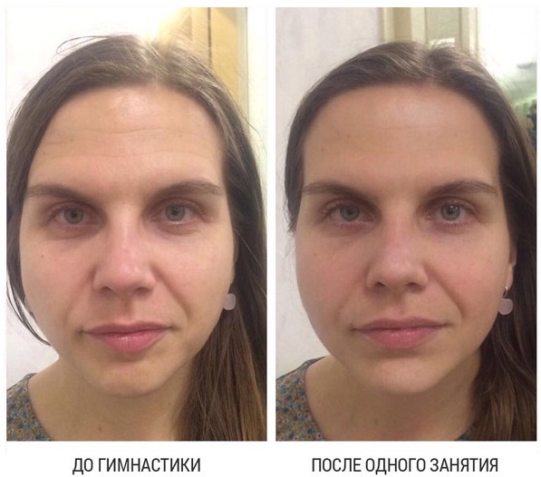 Gezichtsfitnessoefeningen voor het gezicht. Japanse methode, Elena Karkukli, Dubinina, Anastasia Burdyug. Videolessen