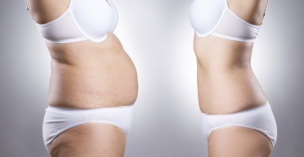 كيفية إزالة أسفل البطن بسرعة عند النساء. التمرين ، يلتف ، النظام الغذائي